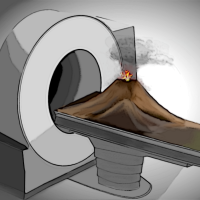 Advances in seismic imaging of magma